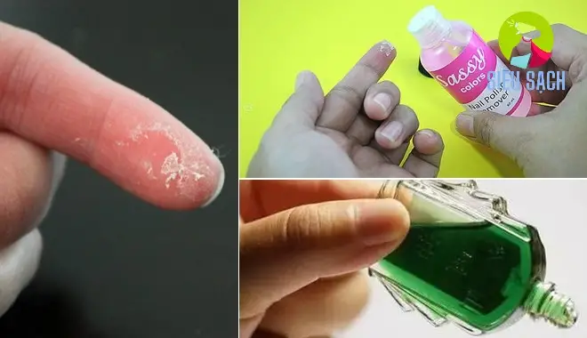 Các Lưu Ý Quan Trọng Khi Loại Bỏ Keo 502 Các Lưu Ý Quan Trọng Khi Loại Bỏ Keo 502