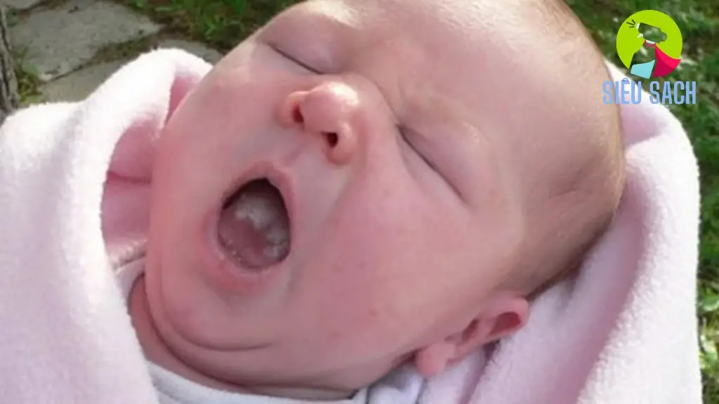 cach lam sach luoi bi trang cho tre so sinh 6918a3a0659b3