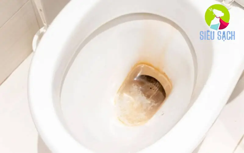 Nguyên Nhân Gây Ra Ố Vàng Trong Nhà Vệ Sinh Nguyên Nhân Gây Ra Ố Vàng Trong Nhà Vệ Sinh