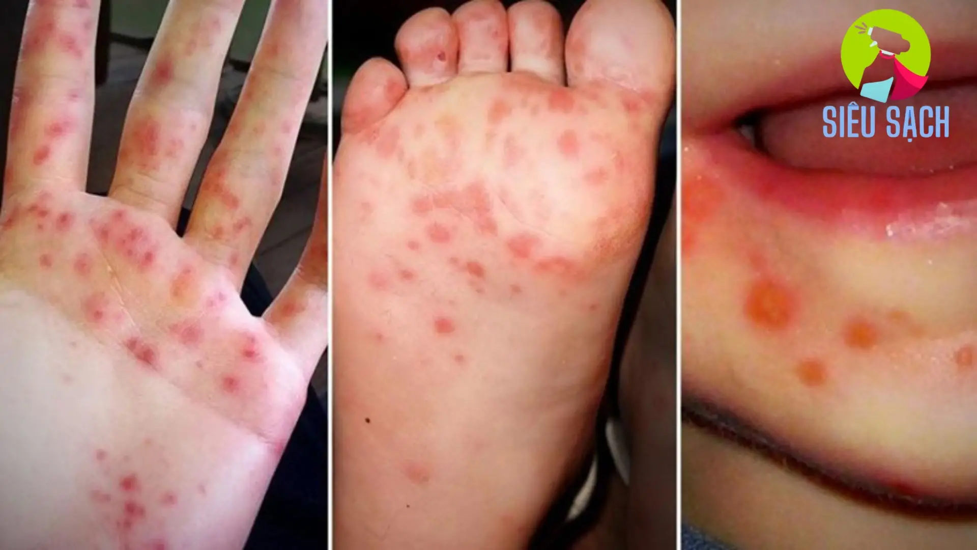 Các khu vực cần đặc biệt chú ý vệ sinh Các khu vực cần đặc biệt chú ý vệ sinh